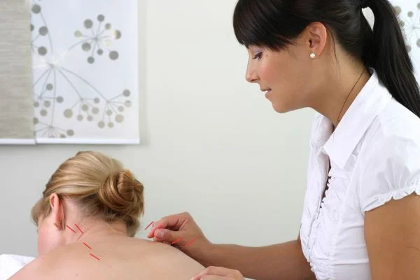 Woman acupuncturist